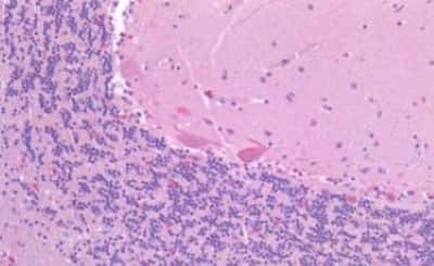 Immunohistochemistry-Paraffin CSMD1 Antibody